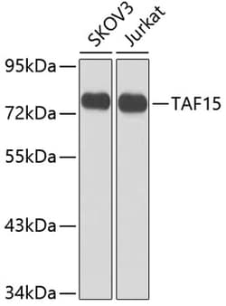 Invitrogen TAF15 Polyclonal Antibody 100 &mu;L; Unconjugated:Antibodies,