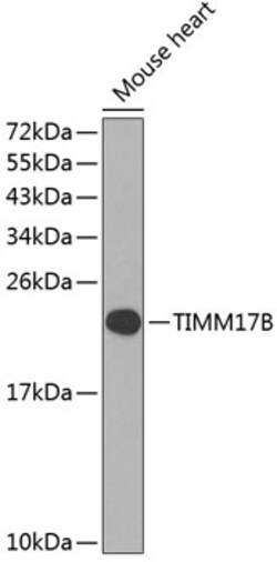 Invitrogen TIMM17B Polyclonal Antibody 100 &mu;L | Buy Online | Invitrogen&trade; | Fisher Scientific