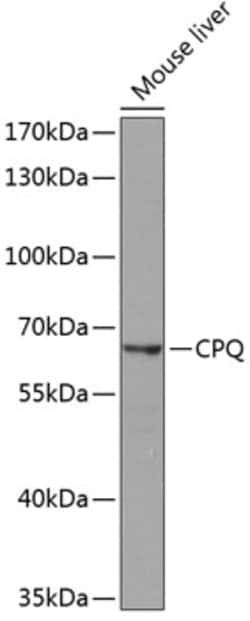 PGCP Polyclonal Antibody 100 &mu;L | Buy Online | Thermo Fisher Scientific | Fisher Scientific