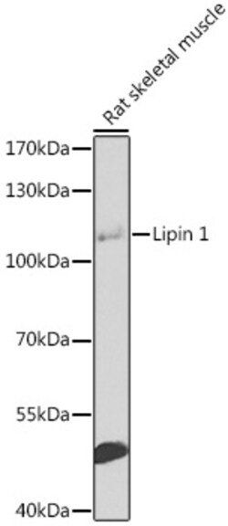 Invitrogen LPIN1 Polyclonal Antibody 100 &mu;L; Unconjugated:Antibodies,