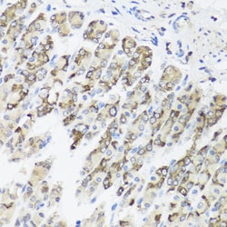 Invitrogen TIMM10B Polyclonal Antibody 100 &mu;L; Unconjugated:Antibodies,
