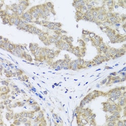 Invitrogen TIMM10B Polyclonal Antibody 100 &mu;L; Unconjugated:Antibodies,