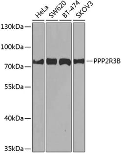 Invitrogen PPP2R3B Polyclonal Antibody 100 &mu;L; Unconjugated:Antibodies,