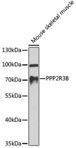 Invitrogen PPP2R3B Polyclonal Antibody 100 &mu;L; Unconjugated:Antibodies,