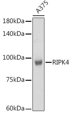 Invitrogen RIPK4 Polyclonal Antibody 100 &mu;L | Buy Online | Invitrogen&trade; | Fisher Scientific