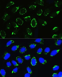 Invitrogen PTCD3 Polyclonal Antibody 100 &mu;L; Unconjugated:Antibodies,