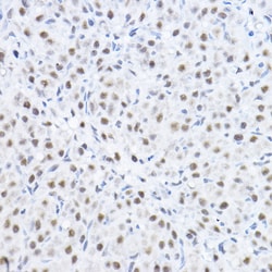 Invitrogen SMEK1 Polyclonal Antibody 100 &mu;L; Unconjugated:Antibodies,