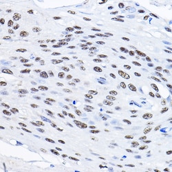 Invitrogen SMEK1 Polyclonal Antibody 100 &mu;L; Unconjugated:Antibodies,