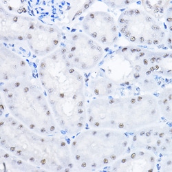 Invitrogen SMEK1 Polyclonal Antibody 100 &mu;L; Unconjugated:Antibodies,