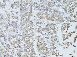 Invitrogen TEFM Polyclonal Antibody 100 &mu;L; Unconjugated:Antibodies,