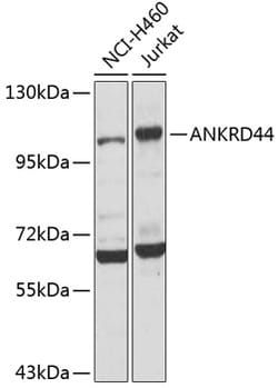 Invitrogen ANR44 Polyclonal Antibody 100 &mu;L; Unconjugated:Antibodies,