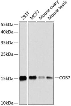 Invitrogen hCG beta-7 Polyclonal Antibody 100 &mu;L; Unconjugated:Antibodies,
