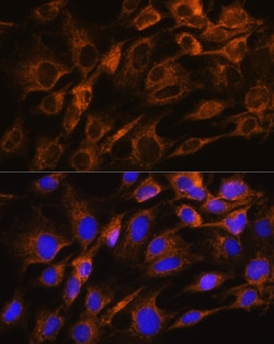 Invitrogen Aquaporin 8 Polyclonal Antibody 100 &mu;L; Unconjugated:Antibodies,
