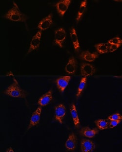 Invitrogen Aquaporin 8 Polyclonal Antibody 100 &mu;L; Unconjugated:Antibodies,