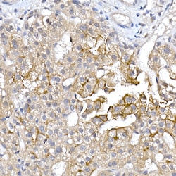 Invitrogen Aquaporin 9 Polyclonal Antibody 100 &mu;L; Unconjugated:Antibodies,