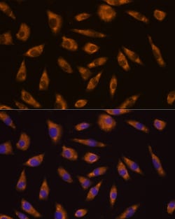 Invitrogen GLP1R Polyclonal Antibody 100 &mu;L; Unconjugated:Antibodies,