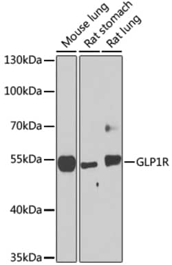 Invitrogen GLP1R Polyclonal Antibody 100 &mu;L; Unconjugated:Antibodies,
