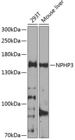 Invitrogen NPHP3 Polyclonal Antibody 100 &mu;L; Unconjugated:Antibodies,