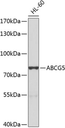 Invitrogen ABCG5 Polyclonal Antibody 100 &mu;L | Buy Online | Invitrogen&trade; | Fisher Scientific