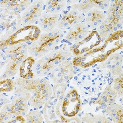 Invitrogen AIFM3 Polyclonal Antibody 100 &mu;L; Unconjugated:Antibodies,