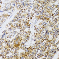 Invitrogen AIFM3 Polyclonal Antibody 100 &mu;L; Unconjugated:Antibodies,