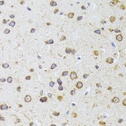 Invitrogen AIFM3 Polyclonal Antibody 100 &mu;L; Unconjugated:Antibodies,