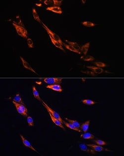 Invitrogen beta-3 Adrenergic Receptor Polyclonal Antibody 100 &mu;L; Unconjugated:Antibodies,