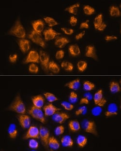 Invitrogen beta-3 Adrenergic Receptor Polyclonal Antibody 100 &mu;L; Unconjugated:Antibodies,