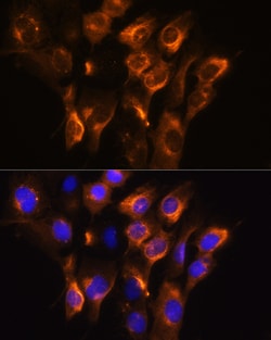 Invitrogen beta-3 Adrenergic Receptor Polyclonal Antibody 100 &mu;L; Unconjugated:Antibodies,