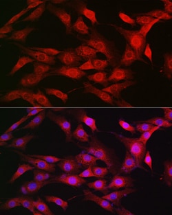 Invitrogen Importin beta-1 Polyclonal Antibody 100 &mu;L; Unconjugated:Antibodies,