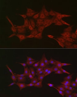 Invitrogen Importin beta-1 Polyclonal Antibody 100 &mu;L; Unconjugated:Antibodies,