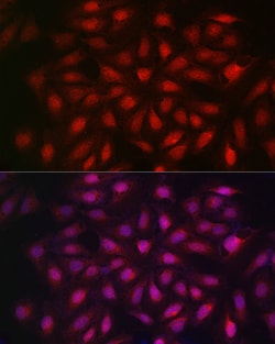 Invitrogen Importin beta-1 Polyclonal Antibody 100 &mu;L; Unconjugated:Antibodies,