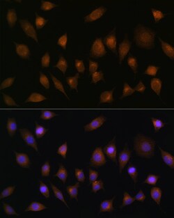 Invitrogen SNX1 Polyclonal Antibody 100 &mu;L; Unconjugated:Antibodies,