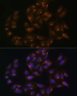 Invitrogen SNX1 Polyclonal Antibody 100 &mu;L; Unconjugated:Antibodies,