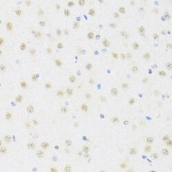 Invitrogen DDX50 Polyclonal Antibody 100 &mu;L; Unconjugated:Antibodies,