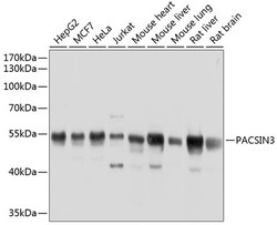 Invitrogen PACSIN3 Polyclonal Antibody 100 &mu;L; Unconjugated:Antibodies,