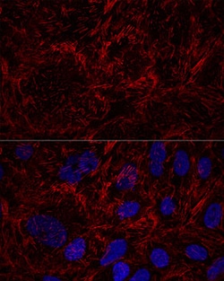 Invitrogen Septin-9 Polyclonal Antibody 100 &mu;L; Unconjugated:Antibodies,