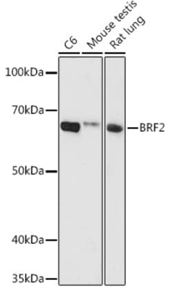 BRF2 Polyclonal Antibody:Antibodies, Polyclonal