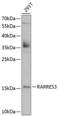 Invitrogen RARRES3 Polyclonal Antibody 100 &mu;L; Unconjugated:Antibodies,