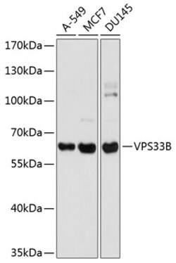 Invitrogen VPS33B Polyclonal Antibody 100 &mu;L | Buy Online | Invitrogen&trade; | Fisher Scientific
