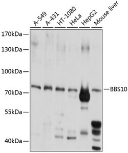 Invitrogen BBS10 Polyclonal Antibody 100 &mu;L; Unconjugated:Antibodies,