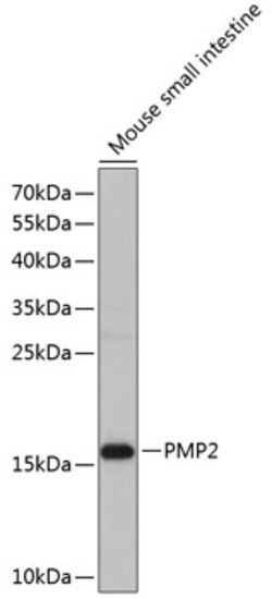 Invitrogen FABP8 Polyclonal Antibody 100 &mu;L; Unconjugated:Antibodies,