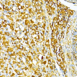 Invitrogen VAMP1 Polyclonal Antibody 100 &mu;L; Unconjugated:Antibodies,