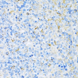 Invitrogen VAMP1 Polyclonal Antibody 100 &mu;L; Unconjugated:Antibodies,