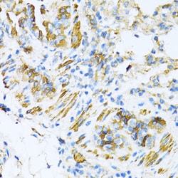 Invitrogen VAMP1 Polyclonal Antibody 100 &mu;L; Unconjugated:Antibodies,