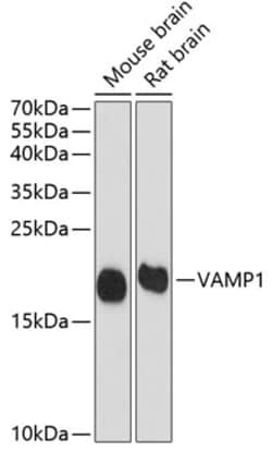 Invitrogen VAMP1 Polyclonal Antibody 100 &mu;L; Unconjugated:Antibodies,