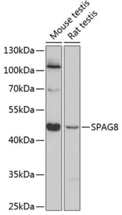 Invitrogen SPAG8 Polyclonal Antibody 100 &mu;L; Unconjugated:Antibodies,