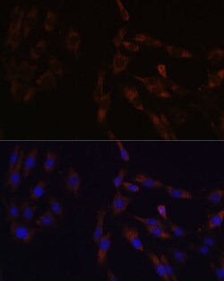 Invitrogen SUCLG2 Polyclonal Antibody 100 &mu;L; Unconjugated:Antibodies,