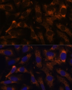 Invitrogen SUCLG2 Polyclonal Antibody 100 &mu;L; Unconjugated:Antibodies,