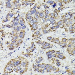 Invitrogen SUCLG2 Polyclonal Antibody 100 &mu;L; Unconjugated:Antibodies,